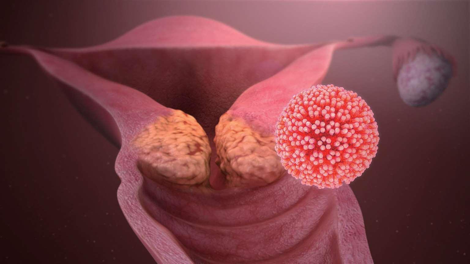 什么是HPV病毒 HPV病毒详解